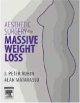 Book cover on surgery after weight loss.