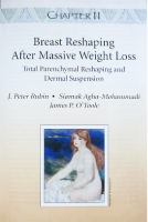 Book cover on breast reshaping after weight loss.